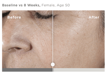 Load image into Gallery viewer, DrFreund Skincare Anti-Aging/Antioxidant SkinMedica HA5® Rejuvenating Hydrator